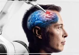 Implan Otak: Harapan Baru bagi Penderita Lumpuh