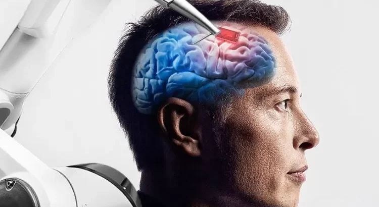 Implan Otak: Harapan Baru bagi Penderita Lumpuh