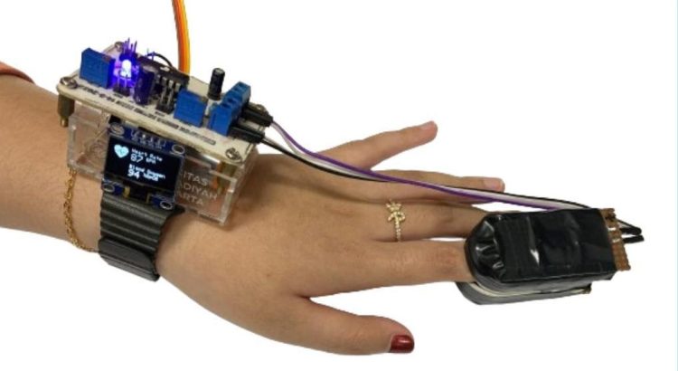 Gelang Ajaib : Deteksi Klakson untuk Tunarungu Kini Hadir!