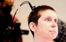 Alat Ini Bantu Penderita Stroke Bicara Lagi
