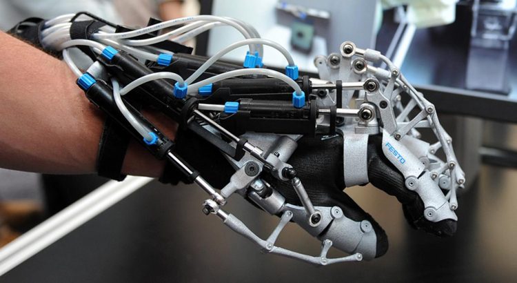 Alat Ini Dikira Gimmick, Ternyata Jadi Penyelamat Pasien Lumpuh!