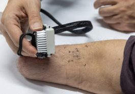 Alat Bantu Tangan Bionik : Tren & Tantangan Teknologi